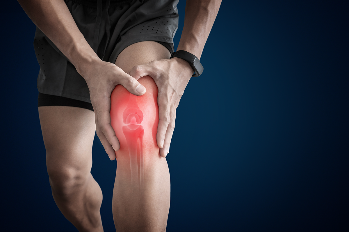 What is the strongest natural anti-inflammatory for arthritis?